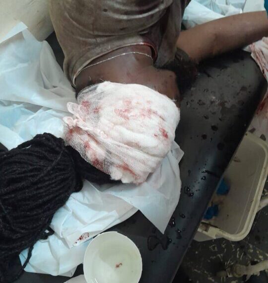 Notícias Sobre o Baleamento do Assessor Politico de Venâncio Mondlane em Quelimane