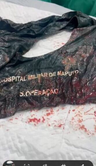 Escândalo Sobre Péssimo Serviço Público Prestado Pelo Hospital Militar de Maputo